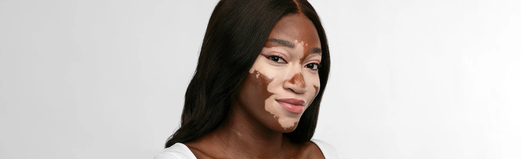Vitiligo Makeup